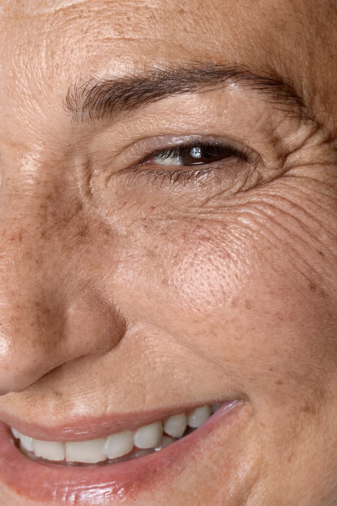 Langkah Sederhana yang Perlu diLakukan untuk Memperlambat Penuaan Kulit Wajah Anda