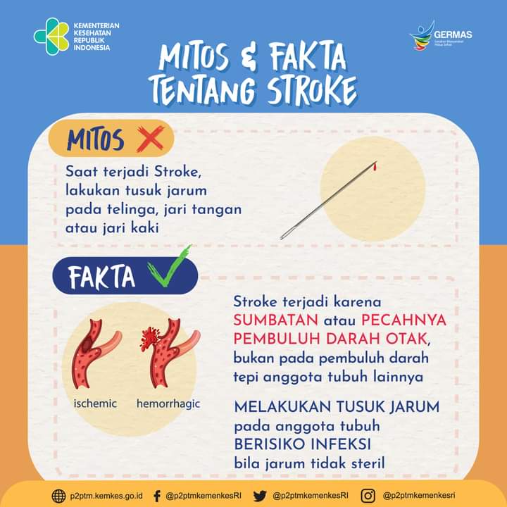 Inilah Cara yang Dapat Dilakukan Untuk Mencegah Stroke