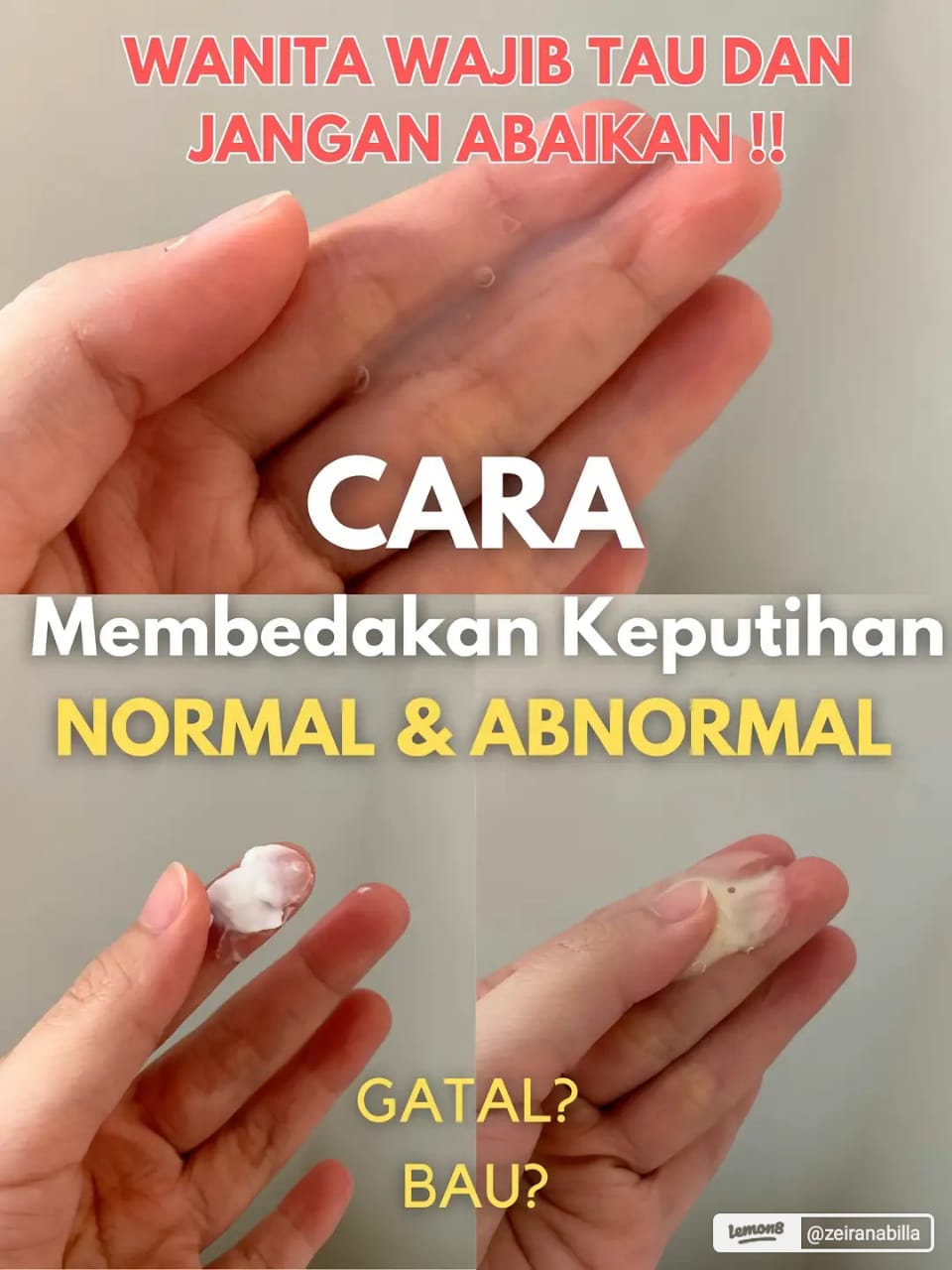 Info Kewanitaan, Kenali Tekstur Keputihan Normal Dan Abnormal