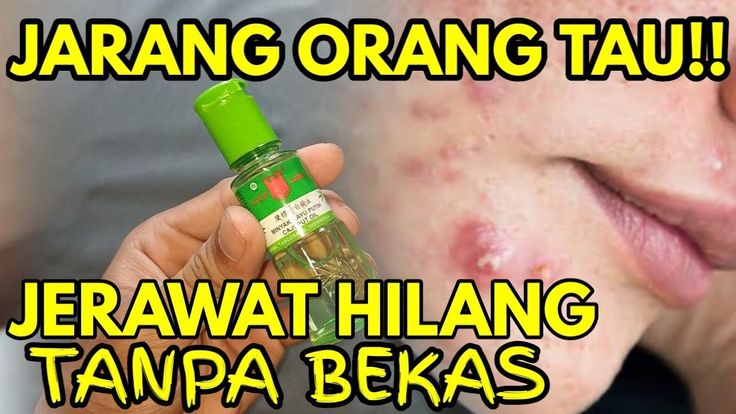 Rahasia Cantik Alami: Manfaat Minyak Kayu Putih untuk Kulit Wajah