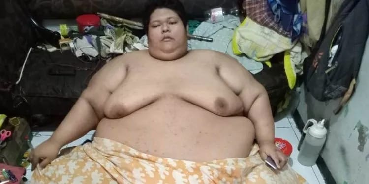 Muhamad Fajri, Pria Obesitas 300 Kilogram Asal Tangerang Meninggal Dunia