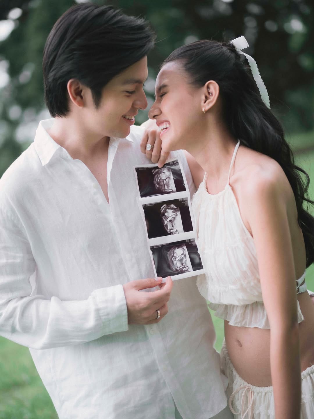Siap-Siap Jadi Orang Tua! Angga Yunanda dan Shenina Cinnamon Segera Sambut Sang Buah Hati