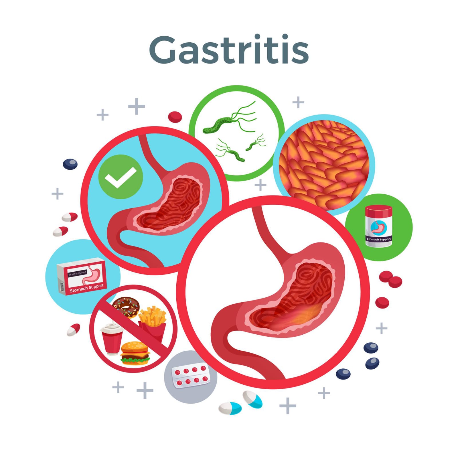 Lakukan Hal ini untuk Menghindari Gastritis saat Berpuasa 
