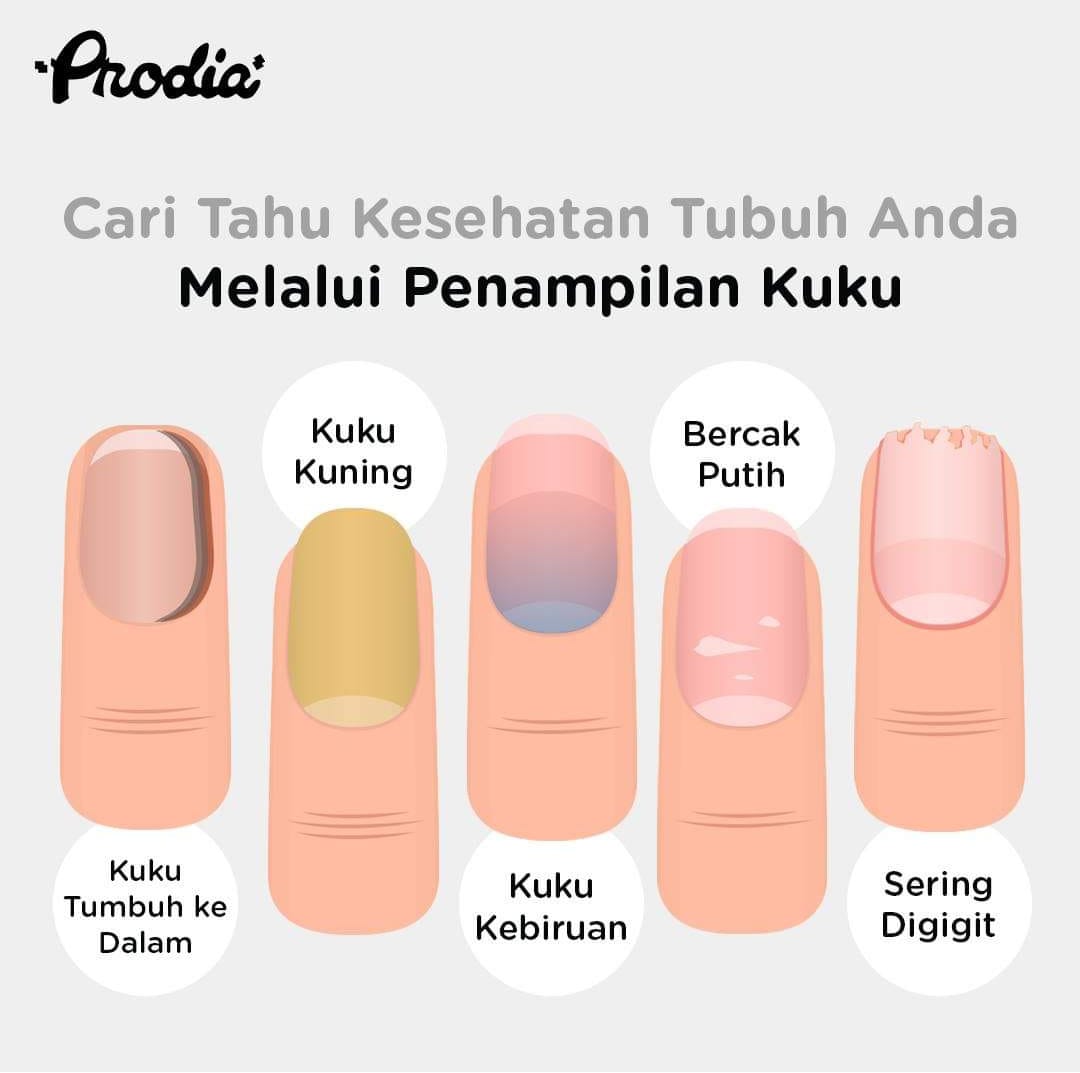 Waspada! Cek Kesehatan Dari Warna Kuku