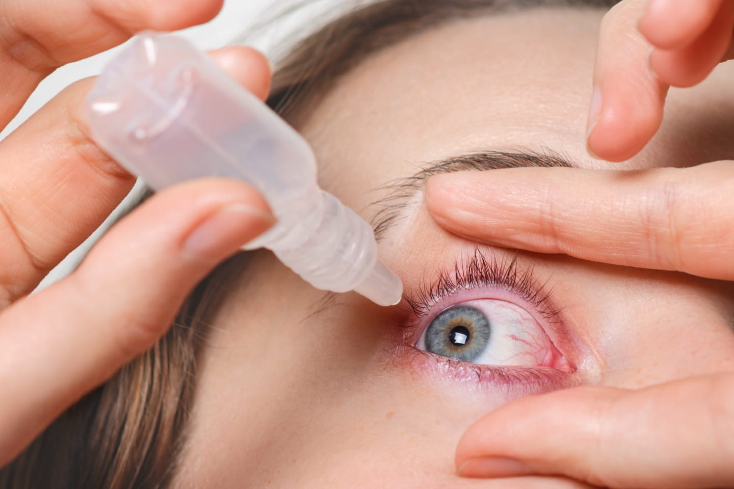 Jangan Asal Pakai! 5 Kesalahan Fatal Saat Memakai Softlens yang Bisa Merusak Mata