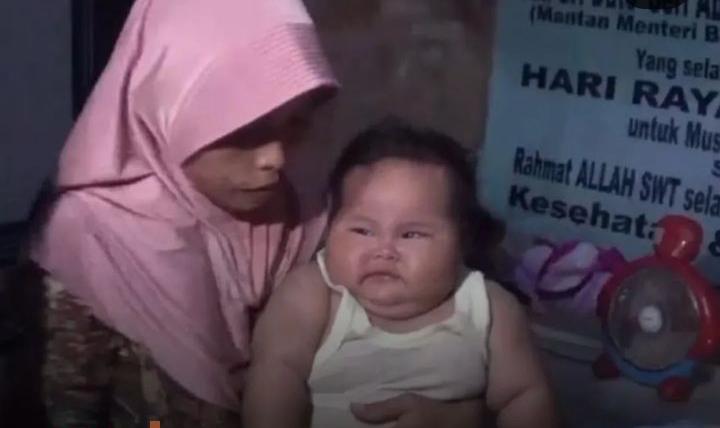 Setelah Fajri, Kini Bayi Tujuh Bulan Asal Bekasi Mengalami Obesitas 