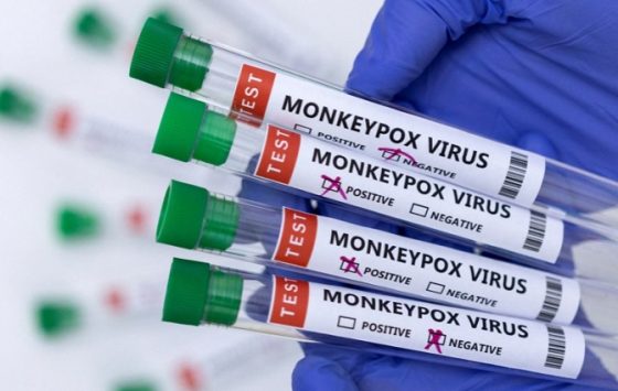 Data Badan Kesehatan Dunia, Inggris Paling Banyak Ditemukan Penyakit Cacar Monyet