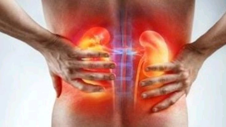 Jangan Anggap Sepele! 5 Tanda Ginjal Mulai Rusak yang Sering Diabaikan