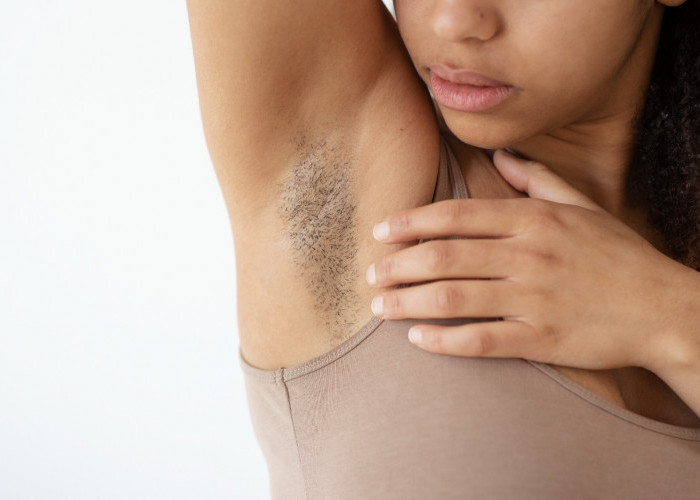 Cara Mengatasi Ketiak Hitam agar Lebih Percaya Diri