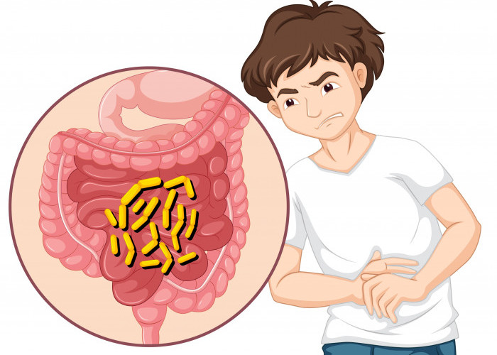 Kenali 7 Tanda Usus Kotor yang Sering Diabaikan, Apakah Kamu Mengalaminya?