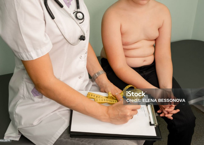 Obesitas Anak Meningkat Tajam, WHO Ingatkan Dampak Jangka Panjang