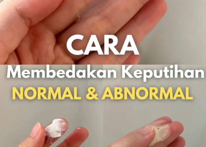 Info Kewanitaan, Kenali Tekstur Keputihan Normal dan Abnormal