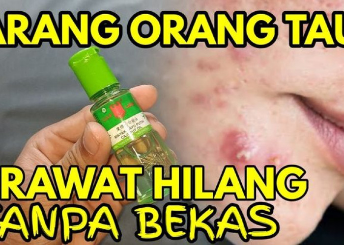 Rahasia Cantik Alami: Manfaat Minyak Kayu Putih untuk Kulit Wajah