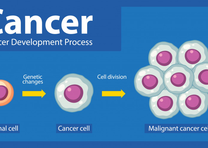 Makanan yang Disukai Sel Kanker: Waspadai Hidangan Sehari-hari yang Bisa Meningkatkan Risiko Kanker