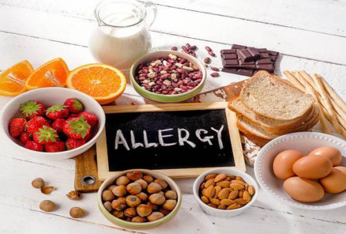 Kenali Alergi Pada Tubuh, Salah-salah Bisa Mengancam Jiwa Lho!