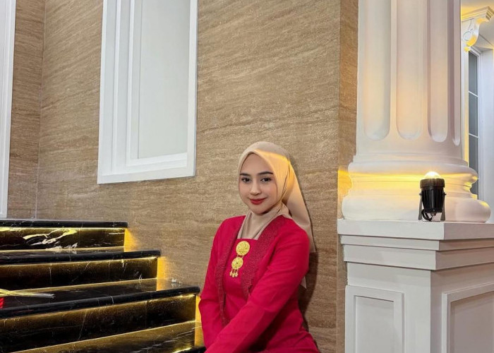 Jalani Operasi Hidung, Ria Ricis Ungkap Ada Alasan Medis di Balik Perubahan Penampilannya