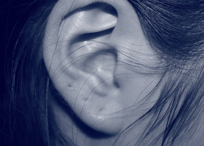 Gangguan Pendengaran Perlu Diwaspadai Lho, Ini Lima Jenisnya