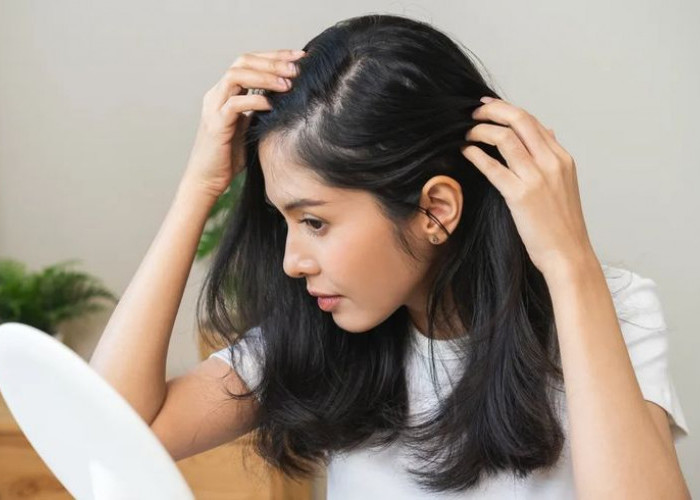 Ketombe Bisa Balik Lagi? Ini Alasan dan Cara Mengontrolnya agar Kulit Kepala Tetap Sehat