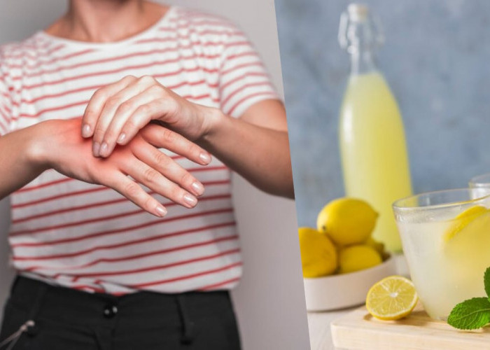 6 Rahasia Minuman yang Ampuh untuk Menurunkan Asam Urat Secara Alami, Salah Satunya Air Lemon!