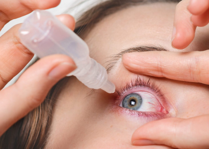 Jangan Asal Pakai! 5 Kesalahan Fatal Saat Memakai Softlens yang Bisa Merusak Mata