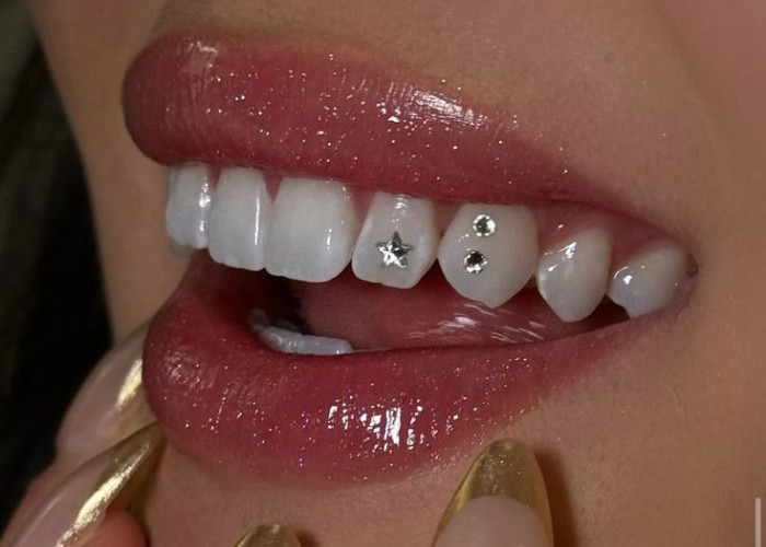 Tooth Gem Jadi Tren Gen Z, Saat Gigi Berubah Jadi Aksesori Fashion yang Viral di TikTok