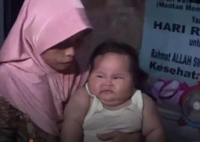 Setelah Fajri, Kini Bayi Tujuh Bulan Asal Bekasi Mengalami Obesitas 