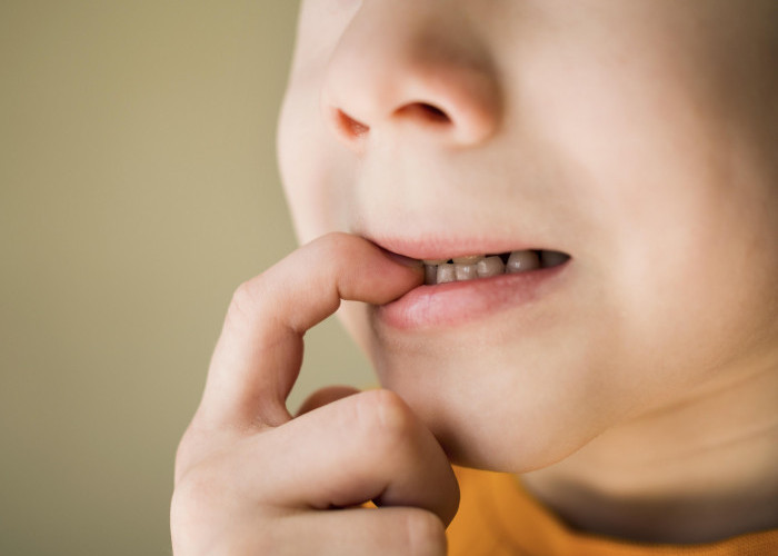 5 Penyebab Gigi Anak Rusak:Ternyata Sering Melakukan Ini