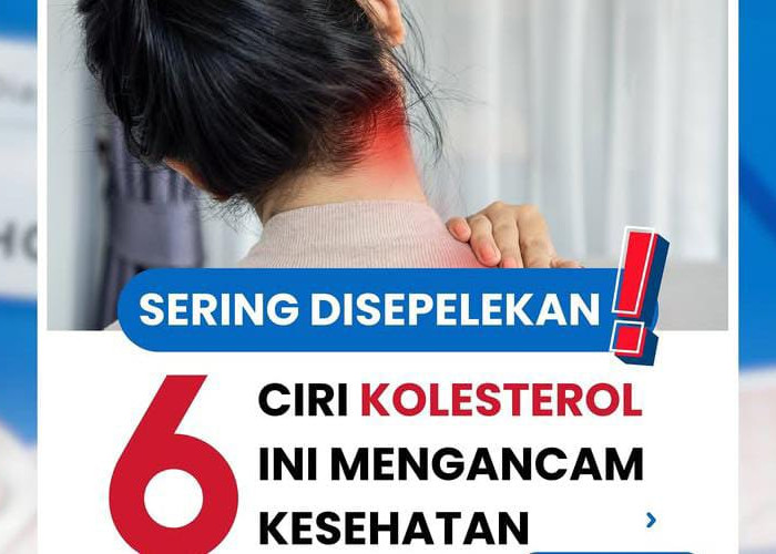 Sering Disepelekan,  Inilah 6 Ciri Kolesterol Mengancam Kesehatan 