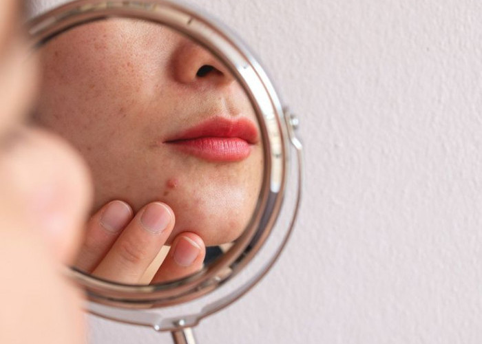 Capek Skincare-an Tapi Kulit Masih Gitu Aja? Coba 3 Jenis Doping Dari Dalam Yang Wajib Kamu Tahu