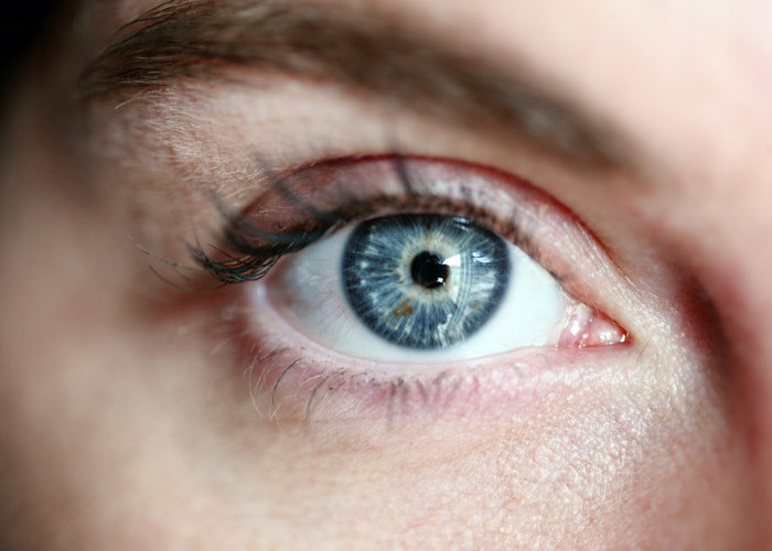 Gejala Kornea Mata yang Tergores: Ini Risiko infeksi yang Akan Terjadi