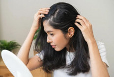 Ketombe Bisa Balik Lagi? Ini Alasan dan Cara Mengontrolnya agar Kulit Kepala Tetap Sehat
