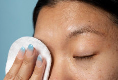 Glycolid Acid dan Salicylic Acid Mana yang Cocok untuk Komedo dan Jerawat