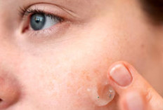 Rahasia Kulit Cerah, 3 Bahan Ajaib untuk Mengatasi Noda Hitam dan Kulit Kusam